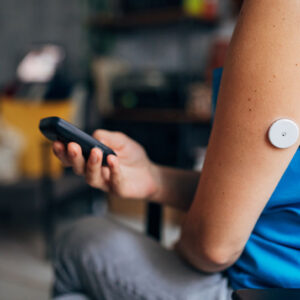 Type-2 diabetes mellitus (DCPD)