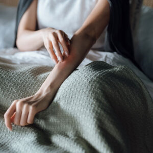 Dry skin, dermatitis & eczema