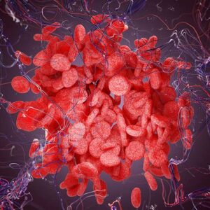 Chronic lymphocytic leukaemia: Latest approaches to diagnosis and treatment (NCPD)