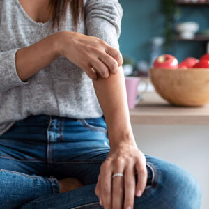 Diagnosing and treating psoriasis