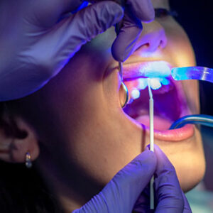 Introduction and applications of lasers in modern dentistry